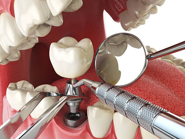 Best Holiday Emergency Dentist in Rio, VA